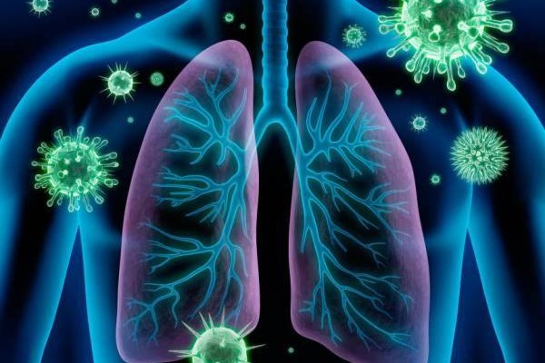 Guia de Estudos: Síndrome Respiratória Aguda Grave (SRAG)