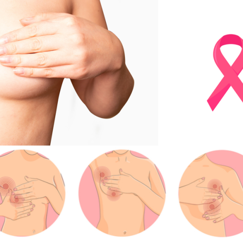 Câncer de Mama: fique atenta e previna-se