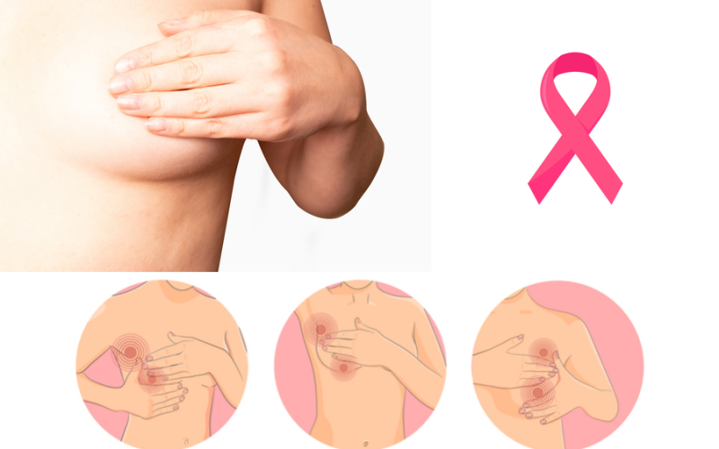 Câncer de Mama: fique atenta e previna-se