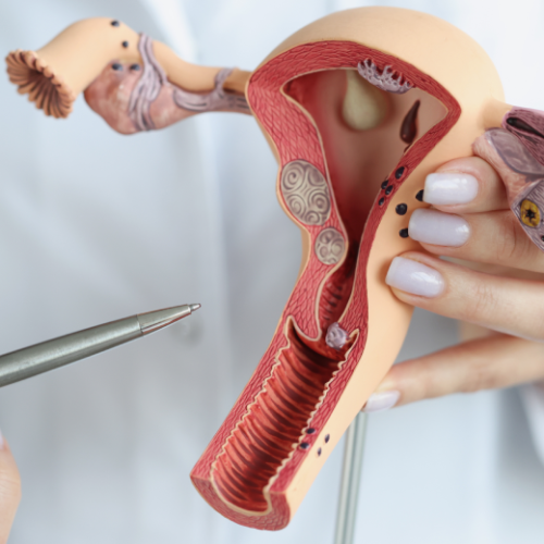 Câncer do colo uterino: alerta e prevenção