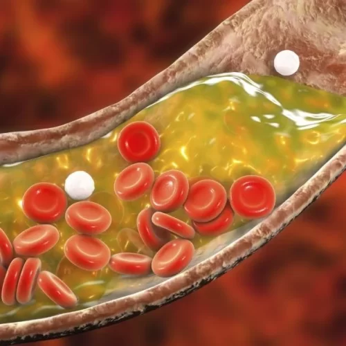 Colesterol: entenda os tipos e como equilibrar