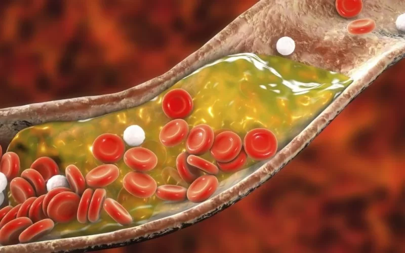 Colesterol: entenda os tipos e como equilibrar