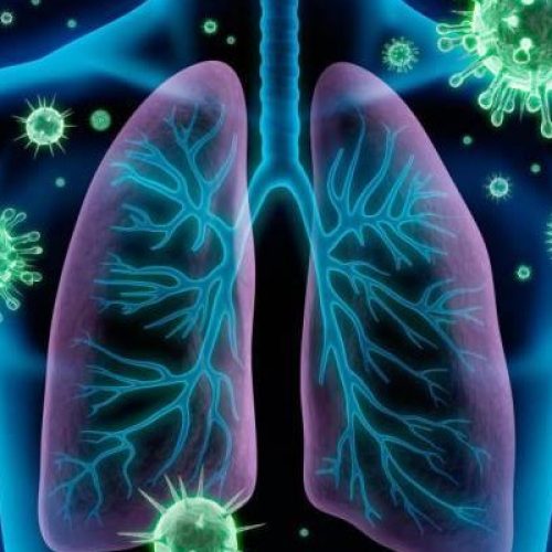 Guia de Estudos: Síndrome Respiratória Aguda Grave (SRAG)