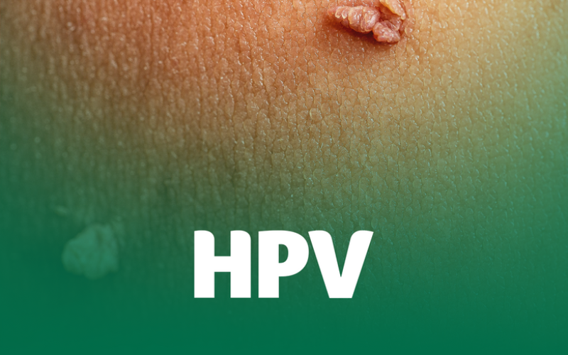 HPV: Entenda o que é, como prevenir e tratar